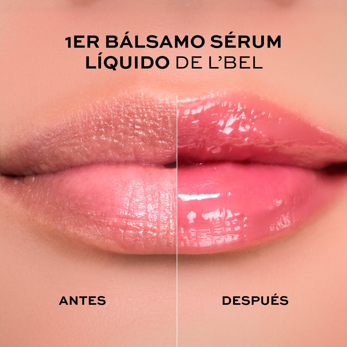 SOLUTIONS PRO-HIALURON LIP TREATMENT