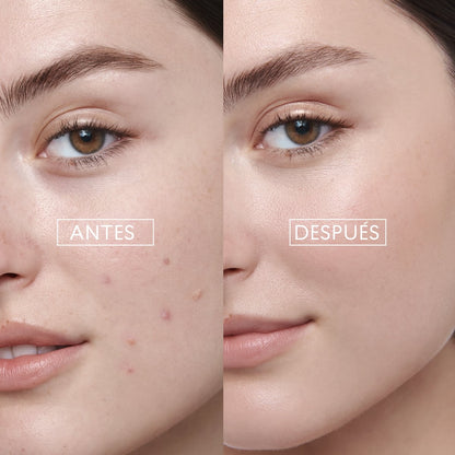 Limpiadora Facial Bye Bye Granitos Skin First, 100 g
