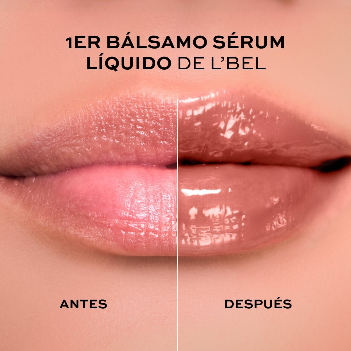 SOLUTIONS PRO-HIALURON LIP TREATMENT