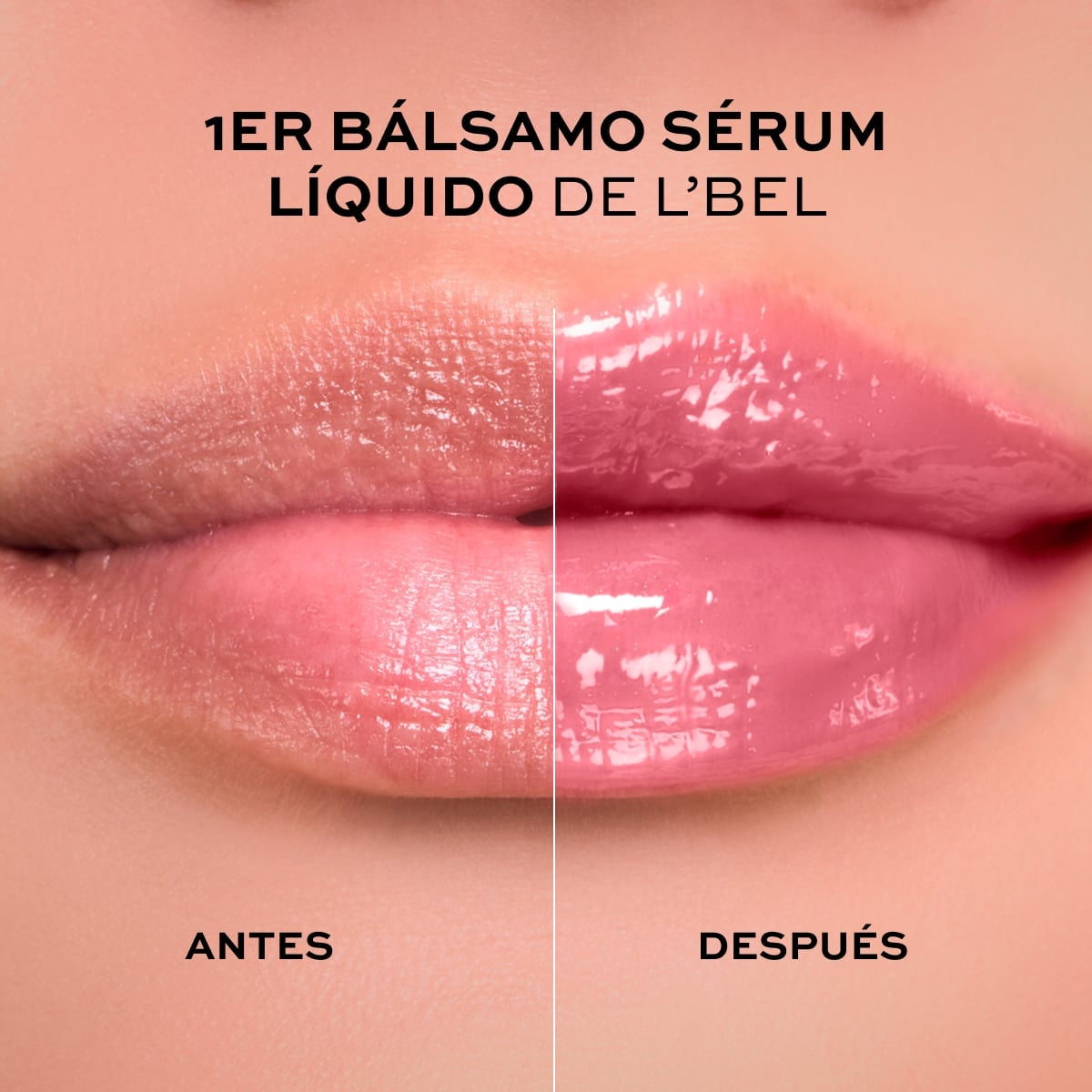 SOLUTIONS PRO-HIALURON LIP TREATMENT