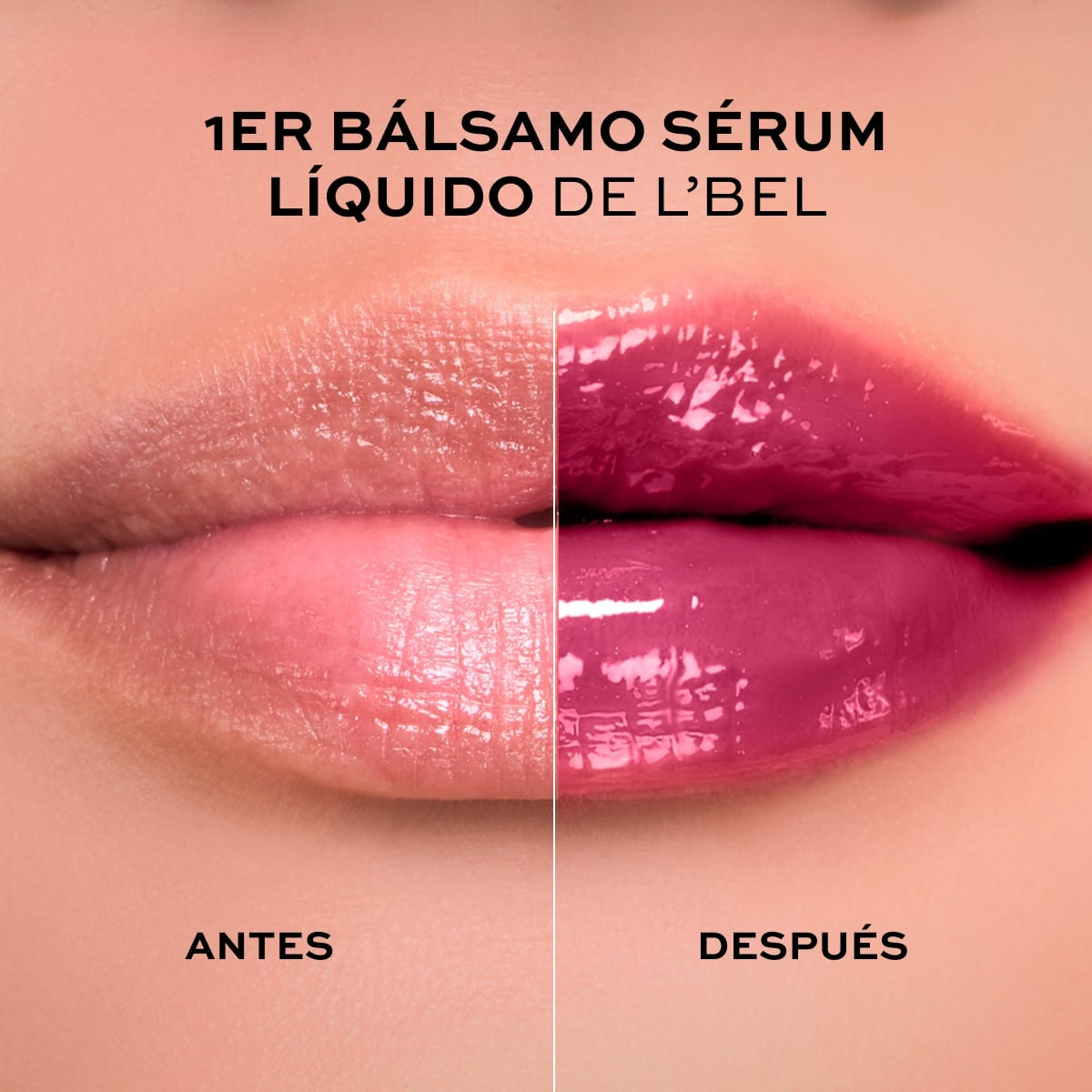 SOLUTIONS PRO-HIALURON LIP TREATMENT